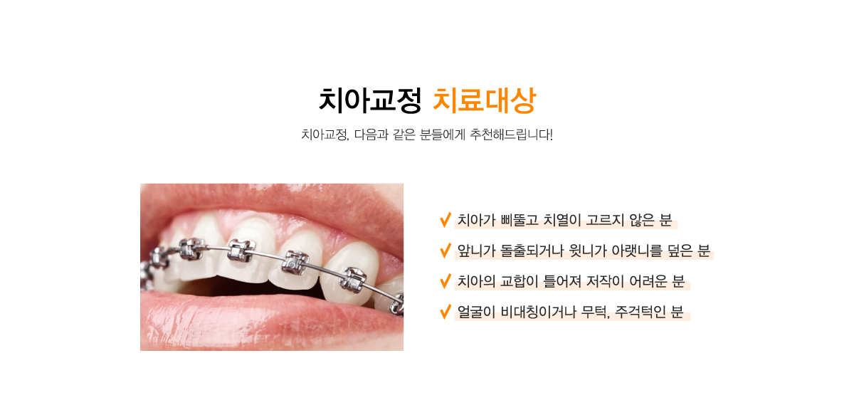 치아교정치료대상