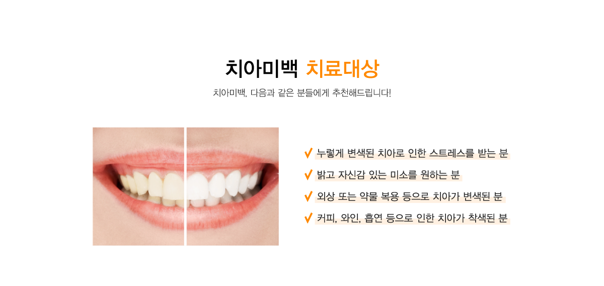 치아미백 치료대상